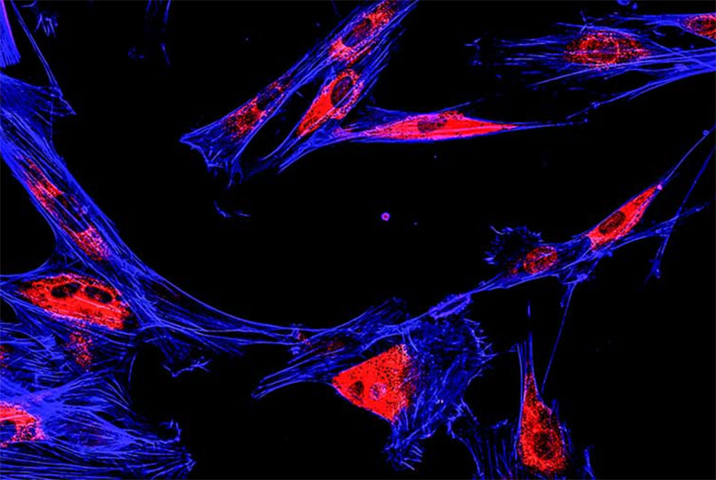 FISH cells
