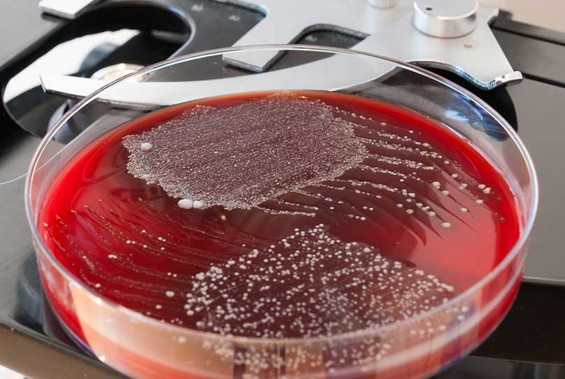 Petri Dish